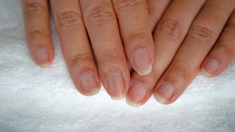 Suche paznokcie potrzebują nawilżenia jak skóra, czy włosy 