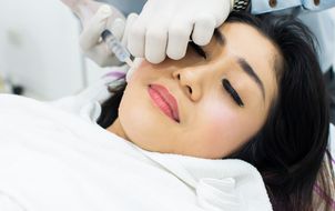Nieudany botox – czoło, usta, policzki. Co robić?