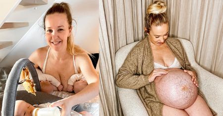 Duńska instagramerka pokazuje BRZUCH PO CIĄŻY i opisuje życie mamy trojaczków: "Sutki czują się jak dwa siniaki"