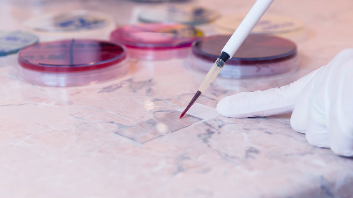 Diagnostyka białaczek