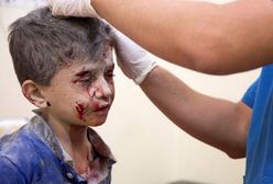 Syria: naloty uszkodziły szkoły, zginęły dzieci