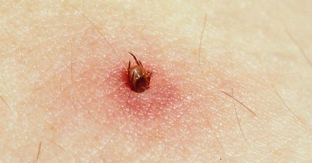 Walka z boreliozą na ostatniej prostej. Śląscy naukowcy o krok od przełomowego odkrycia