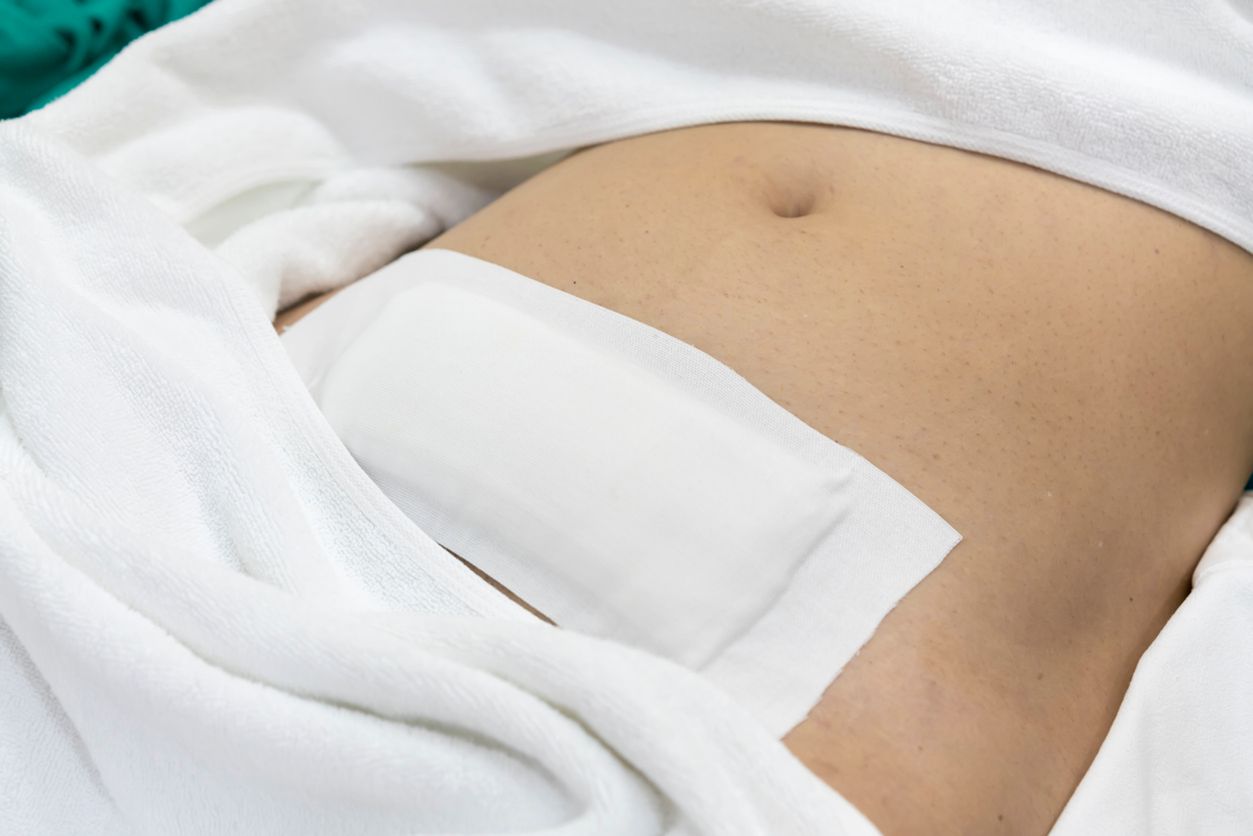 Jedyną przesłanką do bezwzględnego usunięcia macicy są choroby onkologiczne.