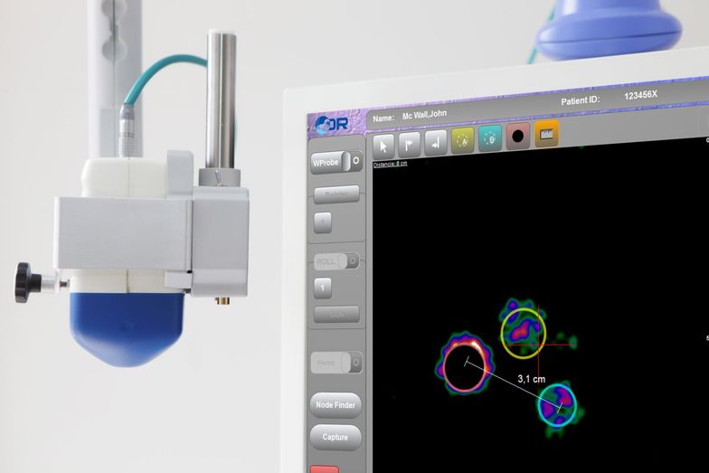 Gamma kamera pozwala z dużą precyzją wskazać komórki rakowe