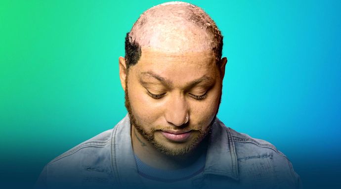 Wszystko przez włosy