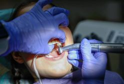 Cena wizyty zwala z nóg. Leczyła tylko dwa zęby