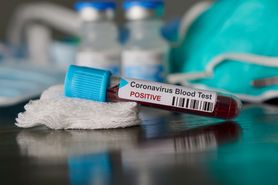 Koronawirus w Polsce. Jaka jest różnica pomiędzy wyzdrowieniem a ozdrowieniem