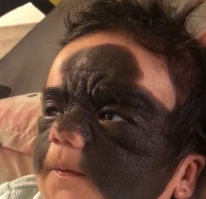 Tak przed operacją wyglądała Luna