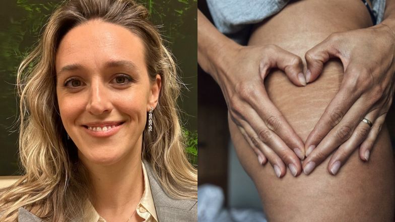 Aleksandra Żebrowska showed off her stretch marks! Here’s what it looks like without retouching