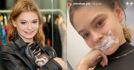 Julia Wróblewska powiększyła usta kwasem. "Będzie pięknie"