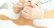 Mikrodermabrazja - na czym polega?