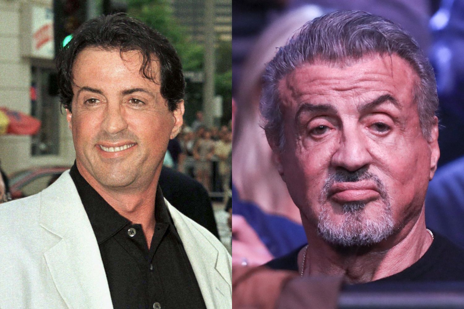 Sylvester Stallone i operacje plastyczne