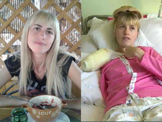 29-letnia Ukrainka STRACIŁA RĘKĘ w koszmarnym wypadku podczas pracy: "Ważniejszy był magiel, niż moje życie"