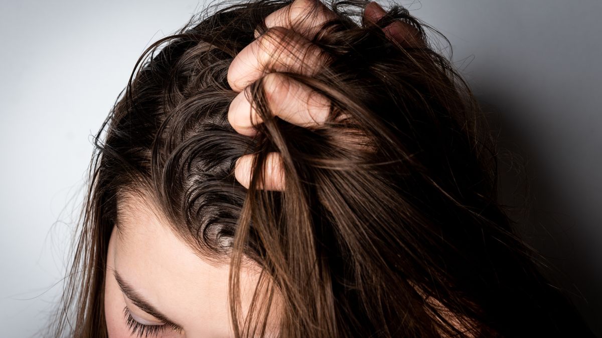 Tłuste, nieumyte włosy.