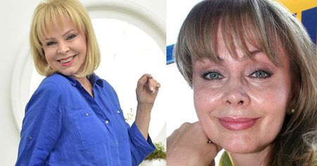 Izabela Trojanowska poprawiła twarz za darmo! Zrobiła zabiegi warte 4500 złotych