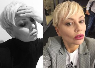 Monika Jarosińska idzie na operację tętniaka! "Będzie chwila grozy, taki mały horror"