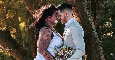 Ludzie nazywali ją potworem. Znalazła miłość i pokazała zdjęcia dziecka