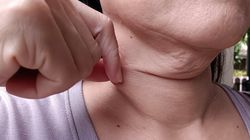 "Brudna" szyja? Tak naprawdę to może być objaw groźnej choroby