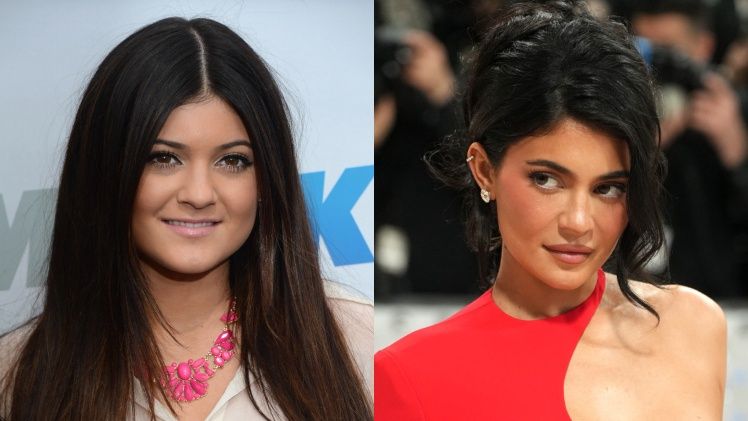 Chirurg przeanalizował wygląd Kylie Jenner