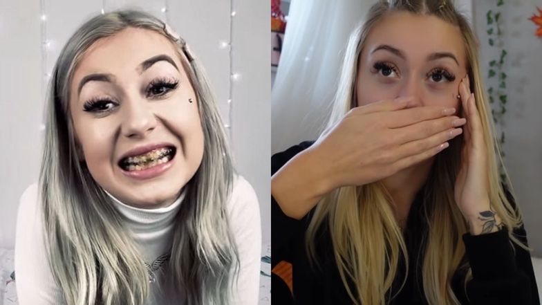 Tiktokerka Kinia Wiczyńska z dumną prezentuje NOWE ZĘBY! 