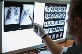 Koronawirus: Lekarze ze szpitala w Wuhan chcą diagnozować COVID-19 za pomocą tomografii komputerowej