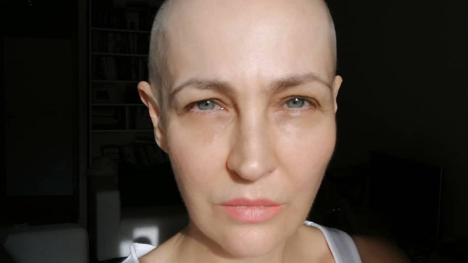 Anna Puślecka o sytuacji chorych na raka w czasie pandemii