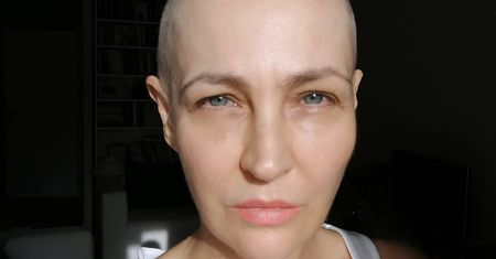 Anna Puślecka walczyła o refundację leku na raka. Teraz zmaga się z innym problemem