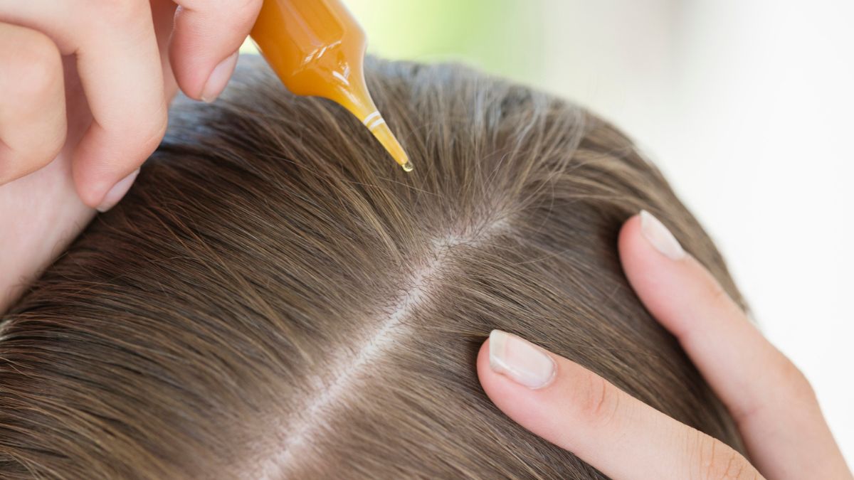 Kobieta aplikuje wcierkę na skórę głowy