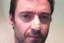 ''Wolverine'': U Hugh Jackmana zdiagnozowano raka