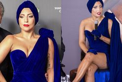 Lady Gaga: w końcu dobrze wygląda, choć nie uniknęła wpadki...