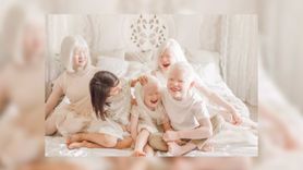 Miłość bez uprzedzeń. Adoptowali 4 dzieci z albinizmem (WIDEO)