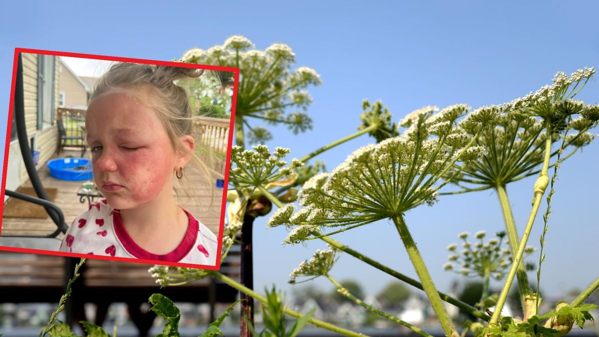 Jedna z najbardziej trujących roślin w Polsce. 6-latka znalazła ją w ogrodzie