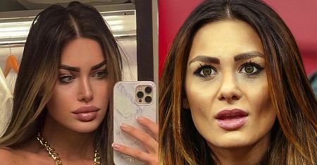 Jessica Ziółek szokuje nową twarzą (FOTO)
