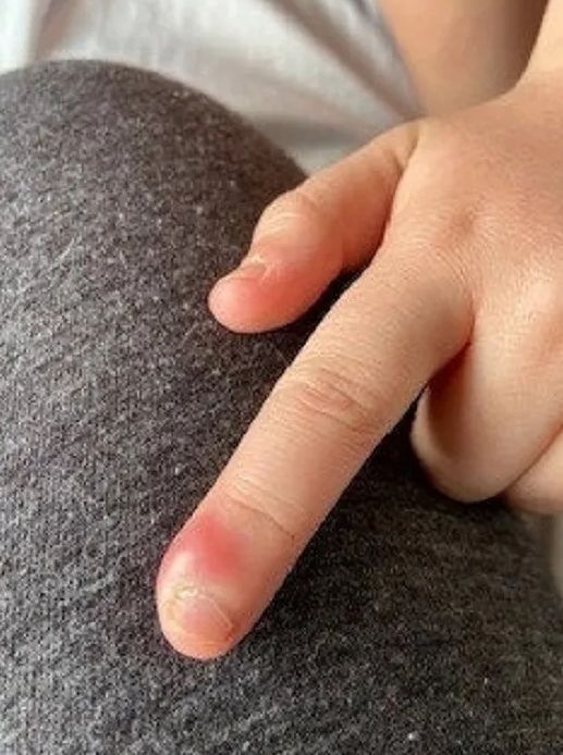 Rodzice nie mieli pojęcia o chorobie syna