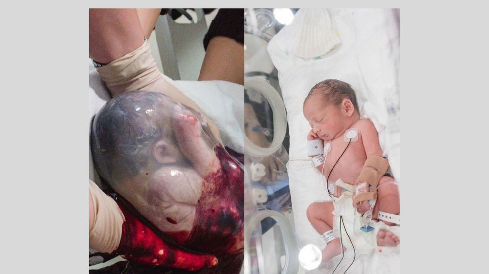 Zdjęcie Angeli Gallo