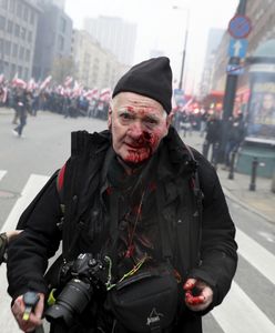 Tomasz Gutry: pocisk, który mnie trafił, miał 7 cm