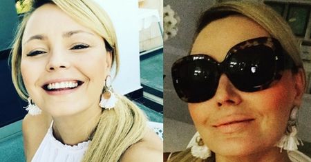 Owocne wakacje Agnieszki Jastrzębskiej: W Grecji puchną jej usta? (FOTO)