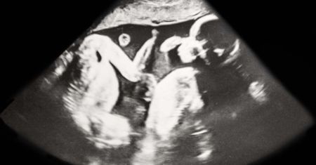 Mama trojaczków nie była na to gotowa. Po porodzie nieźle się zdziwiła