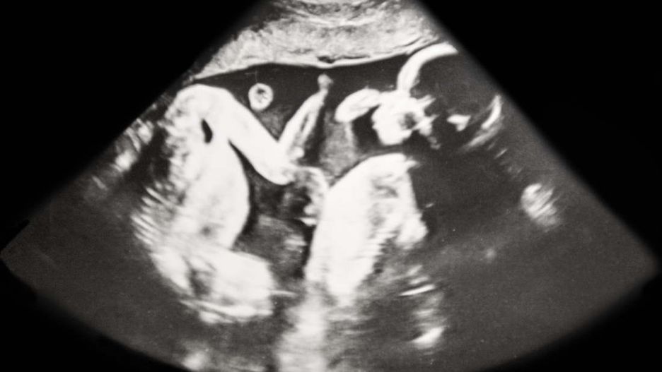 Mama trojaczków nie była na to gotowa. Po porodzie nieźle się zdziwiła