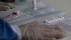 Szymon Mierzyński: Systemowe testowanie piłkarzy nie ma żadnego uzasadnienia (komentarz)