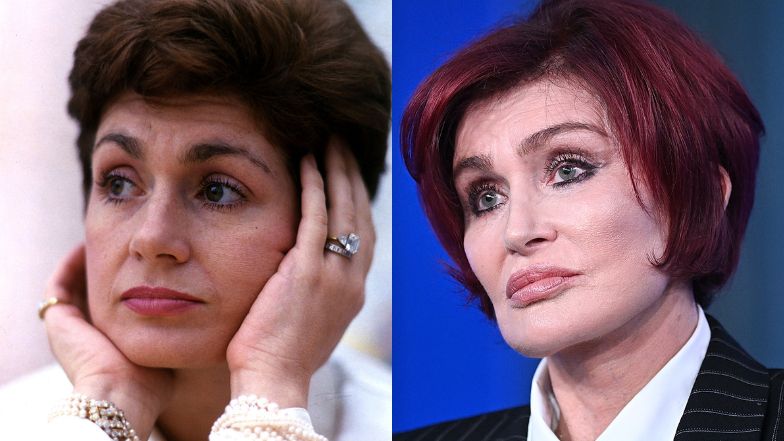Tak zmieniała się twarz Sharon Osbourne