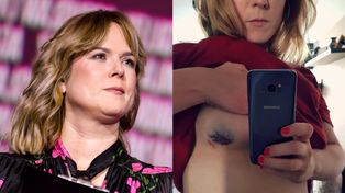 Anna Tatarska z "Dzień Dobry TVN" pokazała ślad po biopsji piersi. Opowiedziała o paraliżującym strachu: "Głowa wariuje" (FOTO)