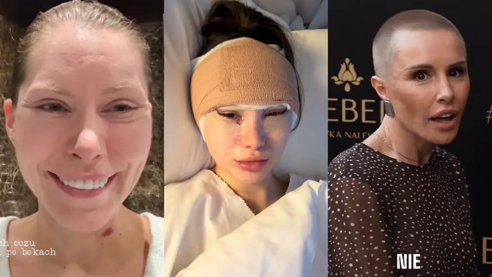 Te gwiazdy i influencerki zrobiły sobie lifting