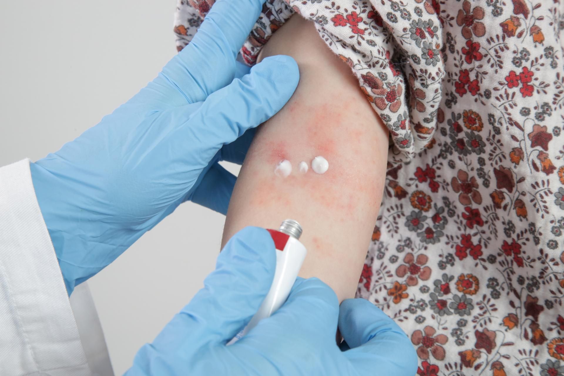 GIF wycofuje maść i krem Elocom