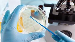 Interpretacja wyniku badania ogólnego moczu