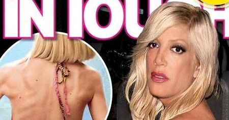 "Beverly Hills, 90210": Tori Spelling trafiła do szpitala. Jej organizm nie wytrzymał!
