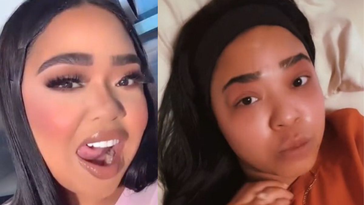 Zrobiła brazylijski lifting pośladków. Bardzo tego żałuje!