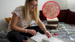 Zauważysz podczas pakowania prezentów. Mogą wskazywać na raka