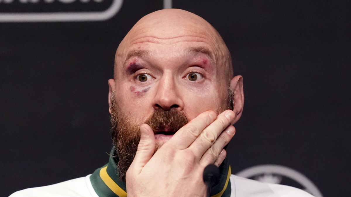 Getty Images / Nick Potts/PA Images / Na zdjęciu: Tyson Fury