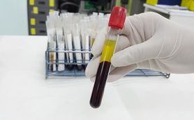 Surowica - co to jest? Surowica krwi, lipemiczna, odpornościowa 